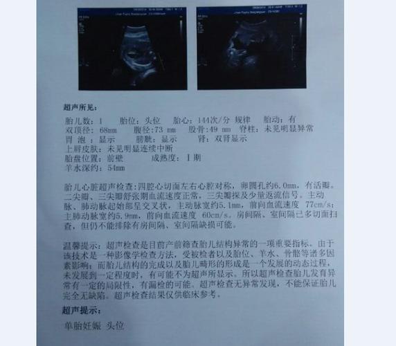胎儿心脏彩超