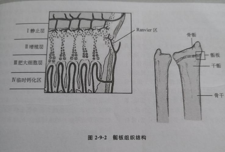 儿童骨骺损伤