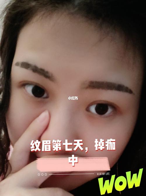纹眉后掉痂的样子_纹眉_美妆_医美整形