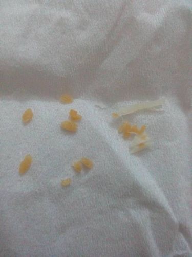 密封装手撕鱿鱼片有黄色颗粒物