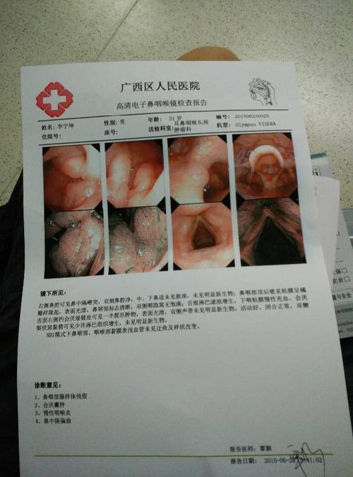 3个月前我脖子有个肿块,加上我有慢性咽喉炎,医生说是淋巴结肿大