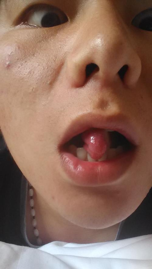 你先练习立舌,然后再试着发小舌音! 追问: 什么是立舌?