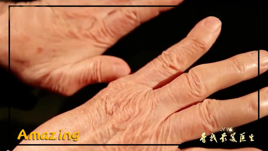 这是医生吴孟超的手.