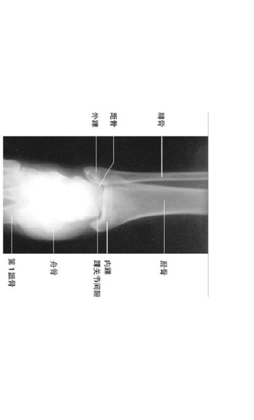 足部x光及解剖图