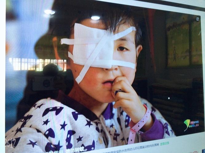 世纪阳光幼儿园小二班安全课(不让眼睛受伤害)