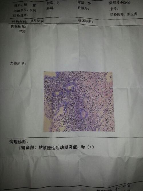 这是胃镜后,诊断出的胃角溃疡的病理报告,还请专家帮看看这严不严重