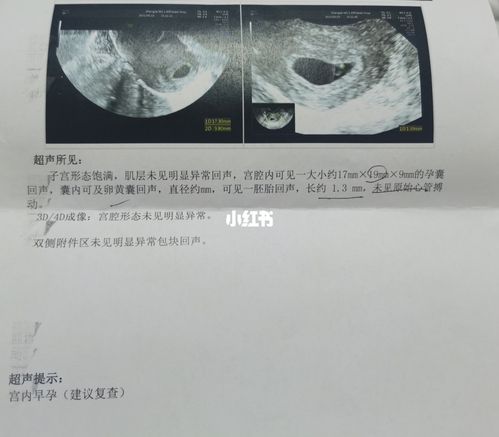 宫内有卵黄囊有胎芽啦