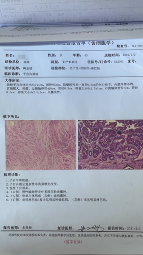 商城县首例——腹腔镜中前哨淋巴结活检