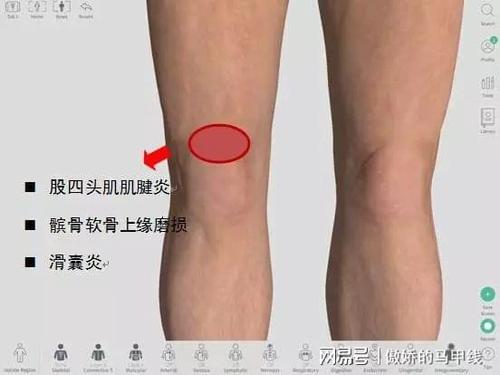 膝盖上方疼痛可能是