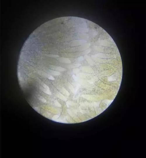 肝小叶饱满,脂肪滴丰富
