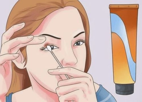 麦粒肿怎么引起的麦粒肿怎么消除快