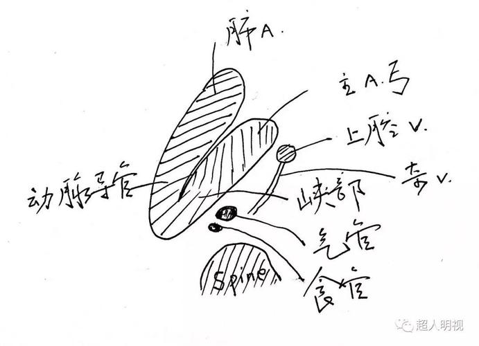 充分理解胎儿三血管气管切面(正常篇)