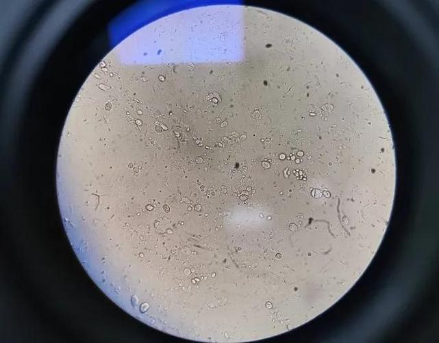 显微镜下的猫屎,竟然和这么多食物都撞脸!_粪便