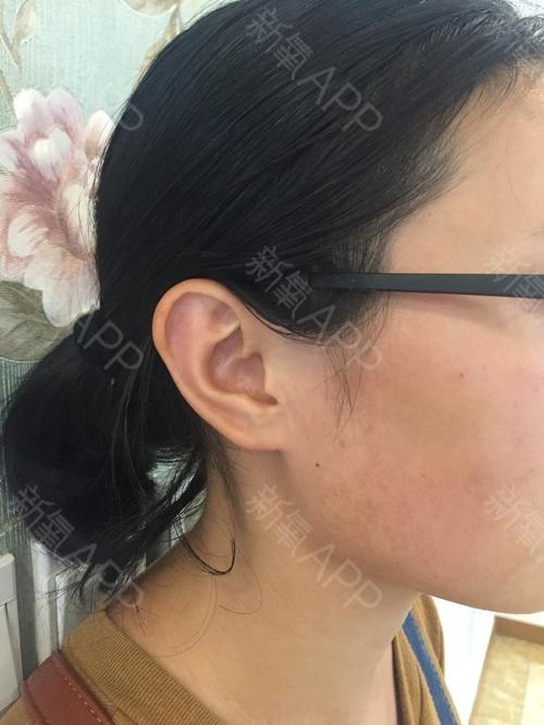 耳垂厚大