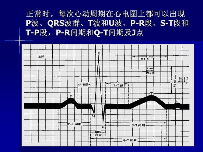 正常心电图学