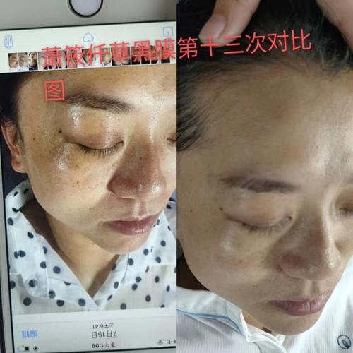 萧筱仟草祛斑淡斑祛黄美白祛痘_祛斑_淡斑_美白祛痘_祛斑淡斑_美妆