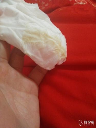 怀孕7周,下体流出来这样的东西,这是什么