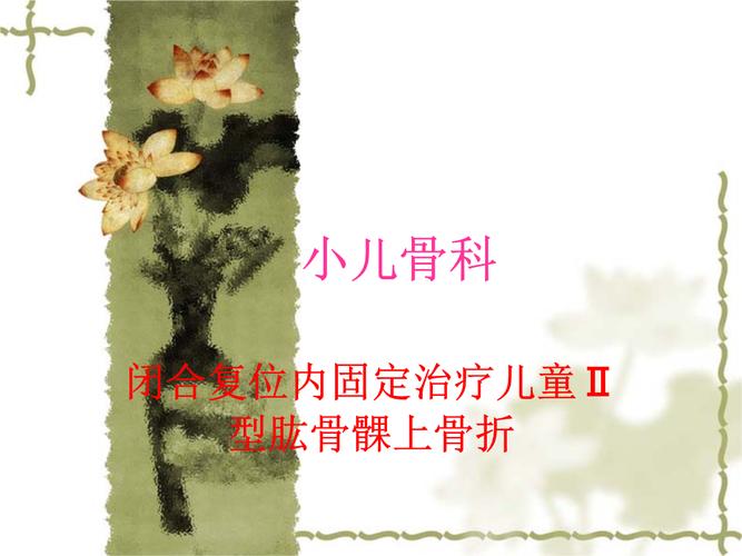 闭合复位内固定治疗儿童Ⅱ型肱骨髁上骨折小儿骨科.ppt