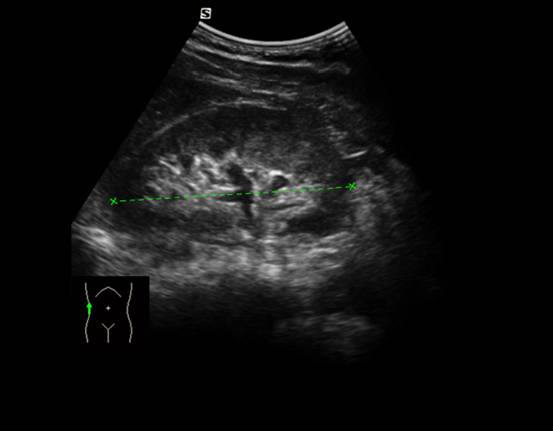 即时助手肾脏超声诊断指南