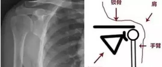 男人肩宽才够味!这么做让你的肩宽再多十厘米