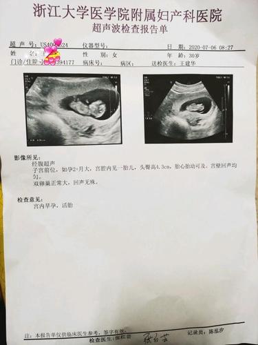 怀孕的10周 2看到b超照片 心都化了!