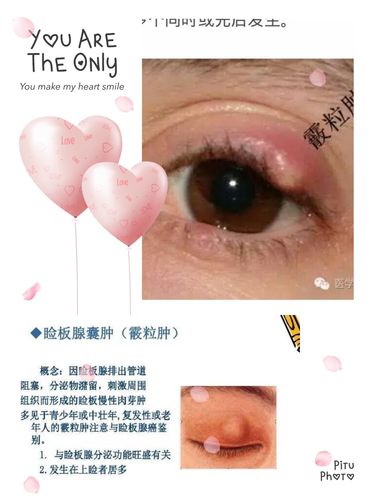 不管是从结膜面做切口,还是从皮肤面,都是整齐的瘢痕