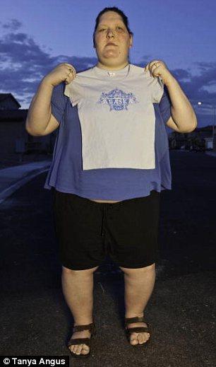 少女患巨人症十余年疯长 淑女变大妈最终猝死