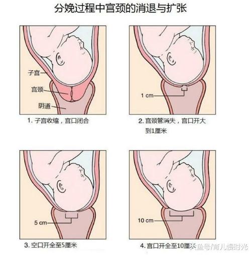 顺产开十指? 骨头裂开十个手指那么宽?