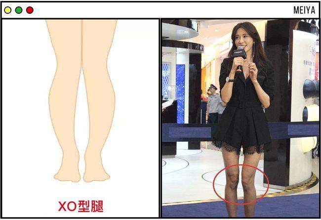 2021美腿新标准来了,原来腿真的不是越细越好!