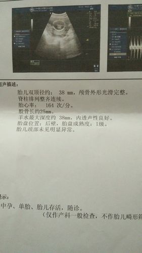 195胎盘成熟度1级