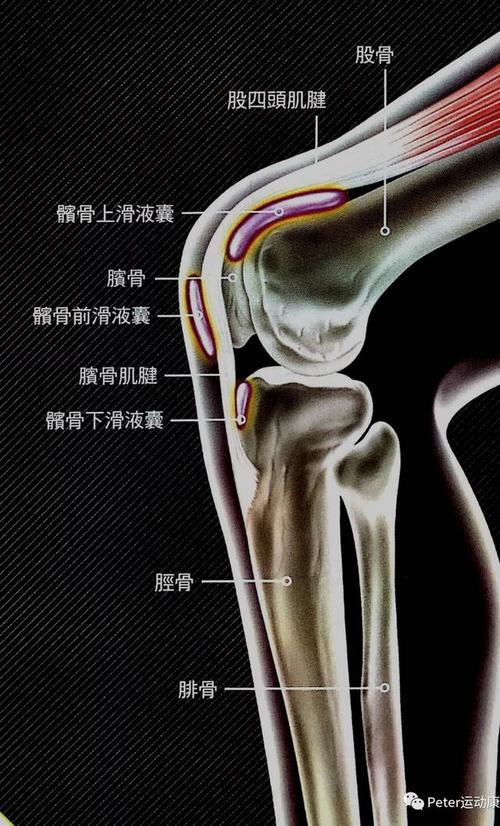 跑者膝/髌前滑囊炎/膝关节前侧疼——不科学地跑早晚要中招