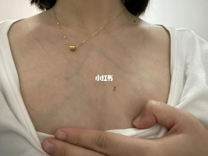 孕晚期脖子青筋暴起_孕晚期_静脉曲张_母婴_孕产经验