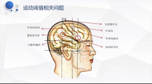 经颅磁刺激临床操作常见问题