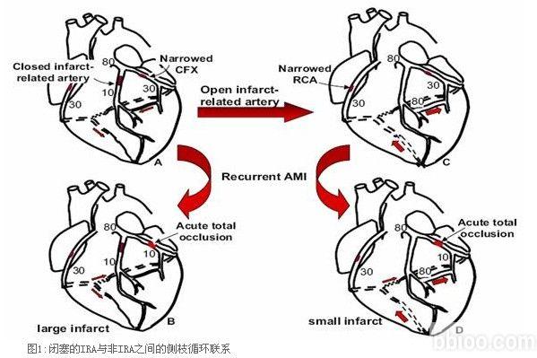 缺血再灌注损伤的原因及条件是什么?