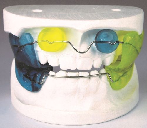 的矫治器是:【图片】 frankel矫治器 herbst矫治器 activator矫治器