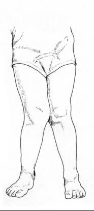 如何判断自己的腿型