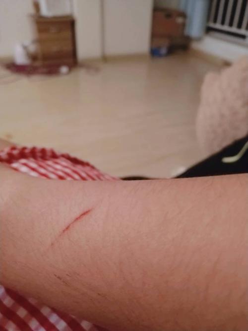 这个痕迹是不是狗抓的?