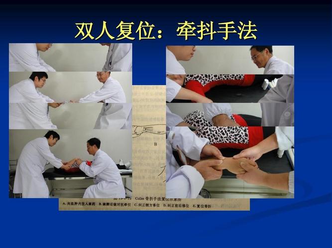 桡骨远端骨折手法.