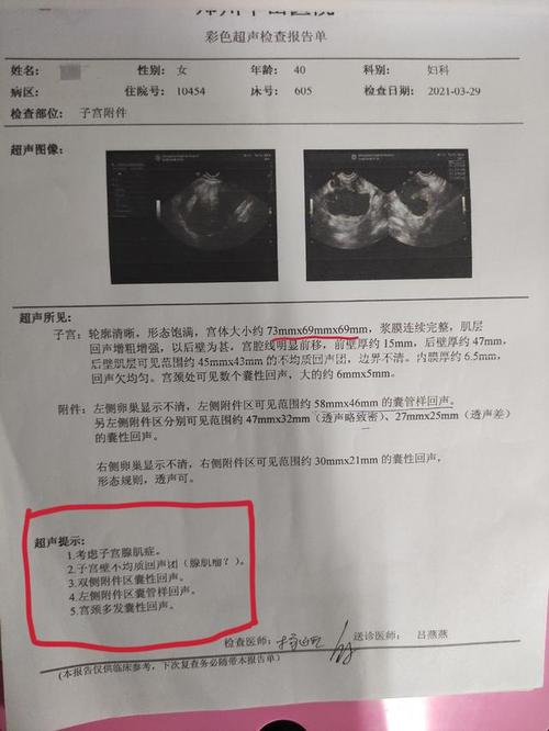5年前无明显诱因出现经期,下腹部疼痛,至当地医院检査彩超提示:子宫腺