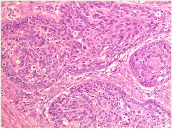 慢性萎缩性胃炎的肉眼病变为()