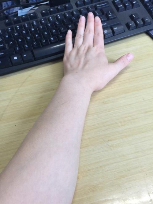 这是刚拍的晒过的胳膊,苹果6后置摄像头,没滤镜,没美颜,外面阴天,自然