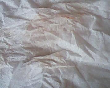 想问问是不是初潮 这三天都有 量很少 请问正常吗?