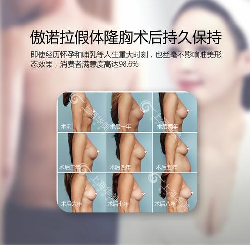 1次 疤痕情况 愈后隐藏 切口位置 腋下,乳晕,乳房下皱襞 3选1 恢复