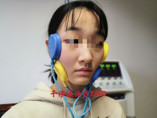 颞下颌关节紊乱病的保守治疗康复篇