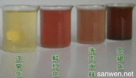 女性尿血的原因及应对措施