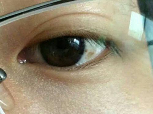 晚上闭灯千万不要玩手机,强光的辐射会让眼睛黄斑病变.