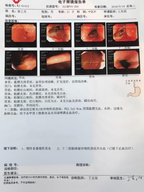 胃疼,胃出血,胃溃疡