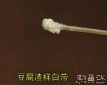 白带异常图片分类