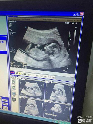 nt宝宝影像,会看男女的宝妈帮看看,谢谢!