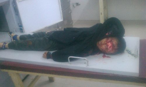 这是躺在太平间里的孩子,已经看不出来是本来的摸样